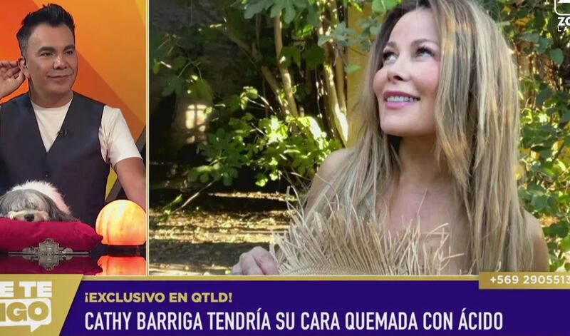 En el programa Que Te Lo Digo de Zona Latina, aseguraron que Cathy Barriga fue atacada con ácido en la cárcel.