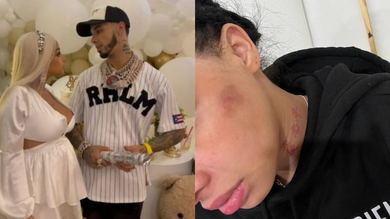 Yailin acusa a Anuel de golpearla mientras estaba embarazada