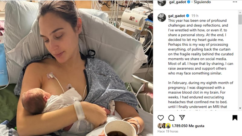 Gal Gadot tuvo que ser operada de emergencia a sus ocho meses de embarazo por tener una trombosis cerebral, que casi le cuesta la vida. Está completamente recuperada.