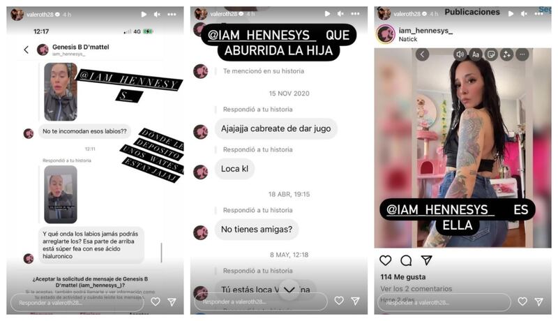 La mediática se quejó en sus historias de Instagram por una seguidora que hace dos años le hace bullying en redes sociales y que este viernes se burló de la forma de sus labios.