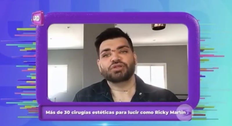 Argentino pasa por más de 30 cirugías para parecerse a Ricky Martin y sus resultados fueron fatales: "Hasta aceite de motos me inyectaron"