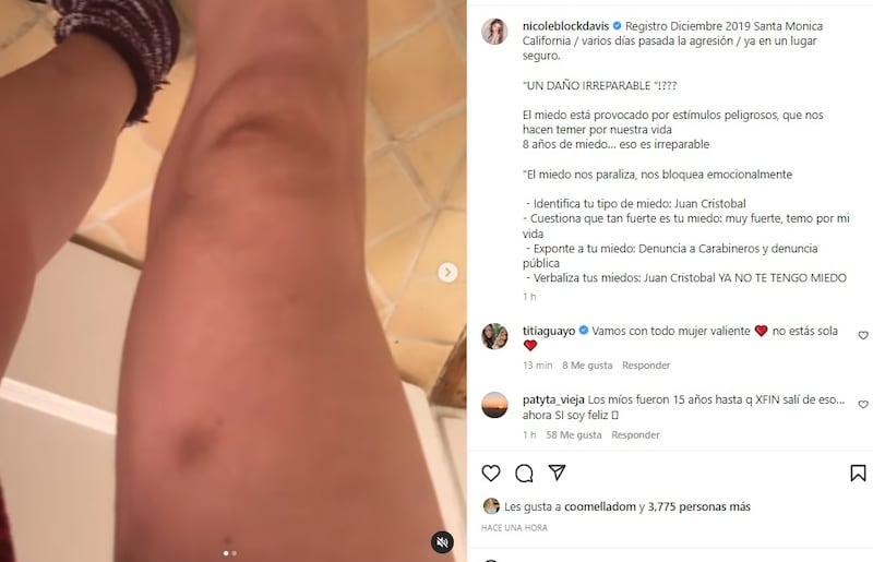 Nicole Block mostró este jueves nuevas evidencias del maltrato sufrido por su marido.