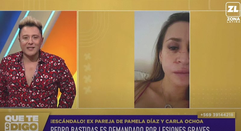 Un demanda por el delito de lesiones graves fue presentada por una mujer contra el modelo, empresario y expareja de Pamela Díaz y Carla Ochoa, Pedro Bastidas, quien le habría propinado un fuerte golpe de puño en la cara en una reconocida discoteque del sector oriente de Santiago.
Los hechos se remontan a la madrugada del 4 de febrero del año 2023, cuando la afectada se encontraba en el Club Amanda de Vitacura y es agredida, en primera instancia por la pareja Bastidas. Información que fue dada a conocer en el programa Que te lo digo de Zona Latina. 
“Llegué en grupo aproximadamente a las 01:00 hrs...bajamos a la pista general y me dan una cachetada. Veo y era Vanessa Lancellotti, novia del querellado”, se lee en la acción judicial presentada al Cuarto Juzgado de Garantía de Santiago, el 11 de octubre del mismo año.
Si bien, la afectada, dijo que prefirió no hacer problemas en ese momento, fue al terminar la noche, cuando todos subían por las escaleras para salir al piso uno, cuando se encontró nuevamente con la mujer, quien la agredió nuevamente. Ataque al cual también se sumó Pedro Bastidas.
“Al subir las escaleras con mucha gente alrededor, siento que llega un líquido a mi cara y cuerpo (alcohol). Al mirar, veo que dos peldaños más arriba iba Vanessa Lancellotti junto al querellado”.
En ese momento, la demandante reconoce que respondió a la agresión y lanzó de vuelta el vaso que llevaba en su mano, dándole en el rostro a la mujer.
“En eso siento que ella se abalanza a mí, comienza a pegarme golpes de pies y mano y de la nada, el querellado me propina con su mano empuñada un golpe en el rostro (un combo literalmente), con lo que caigo por las escaleras y pierdo la conciencia por unos minutos (un knock out)”, describió.
Dando cuenta además que “el querellado es un tipo musculoso y de una contextura muy superior a mi persona, quien abusando de su superioridad de sexo, fuerza y actuando sobre seguro, al verme en el piso, además, me sigue golpeando”.