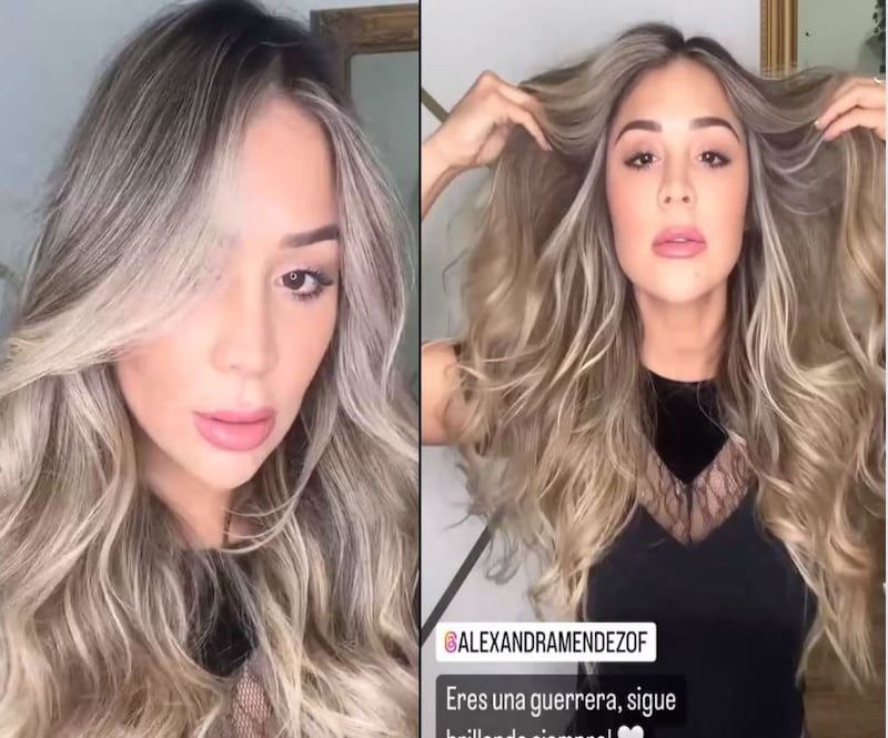 La participante de Tierra Brava, Alexandra Méndez, más conocida como Chama, sorprendió a sus seguidores sus redes sociales al mostrar su nuevo color de pelo, totalmente rubia. Así lo dio a conocer en las historias de Instagram , tras su salida del reality de Canal 13.
Si bien, el programa aún se encuentra en pantalla, lo cierto es que los participantes hace semanas que dejaron de grabar y Chama, actualmente, se encuentra en España.
Según informó el medio Página 7, Alexandra fue atendida por la estilista Marge Bencomo, en la ciudad de Madrid, quien le quitó su melena castaña.
“Le estamos realizando una técnica que se llama sexyblend, donde vamos a iluminar toda la parte de su rostro”, indicó la especialista del centro de belleza.
“Amé mi pelo, súper rubio, espectacular”, dijo la venezolana, bromeando que volvería cada seis meses a Madrid para someterse a un fashion emergency.