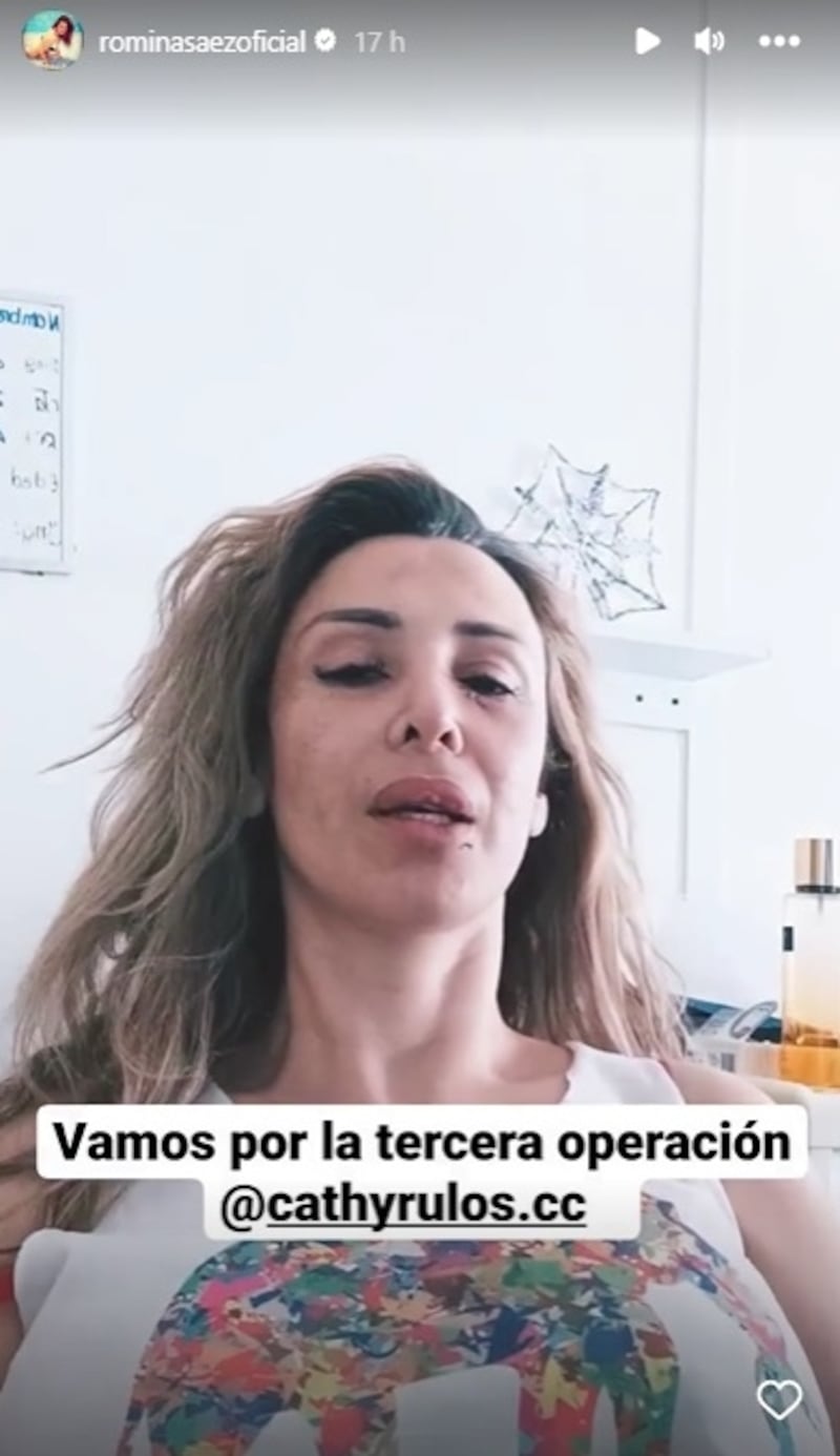 La modelo subió a sus historias de Instagram los pormenores de su ingreso a pabellón para operarse por tercera vez de los golpes que recibió de parte de sus arrendatarios.